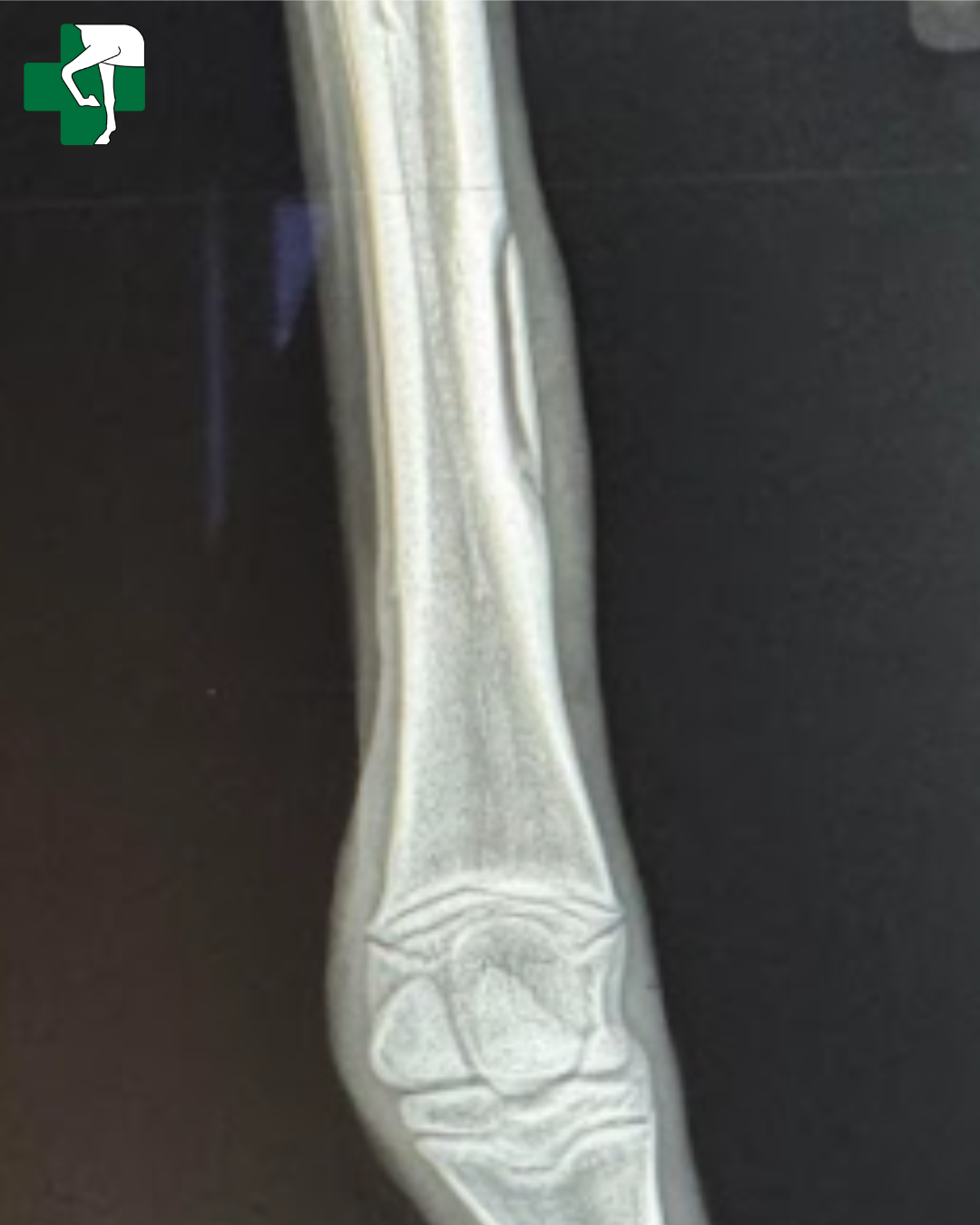 Bone fragment_2
