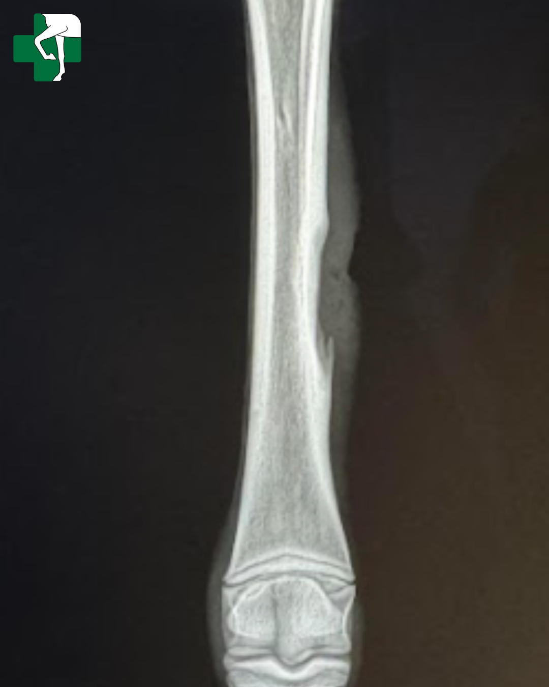 Bone fragment_3