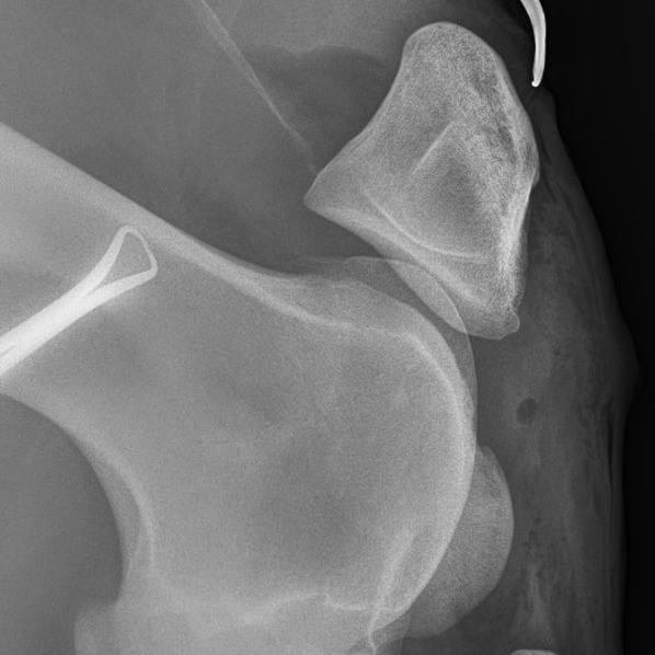 stifle arthroscopy xray_2